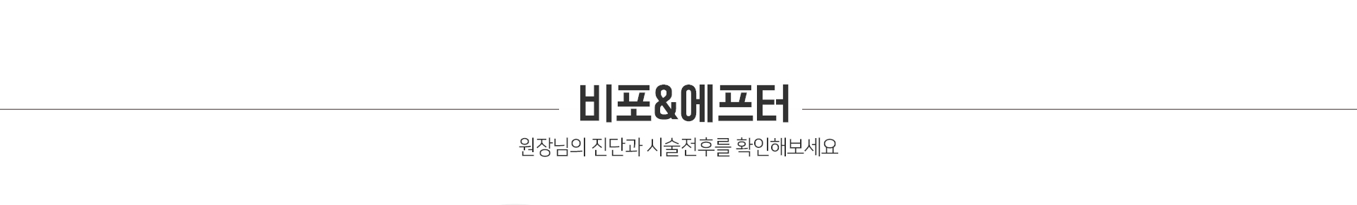 비포에프터